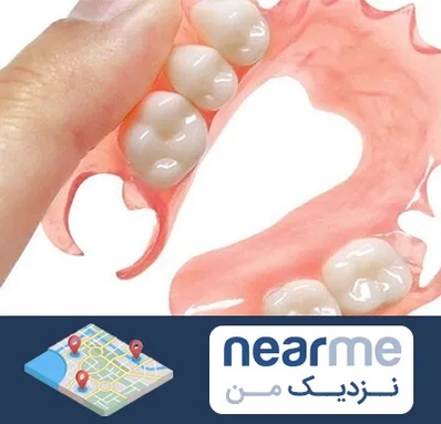 پروتز متحرک دندان در نزدیک من