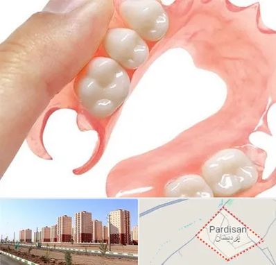 پروتز متحرک دندان در پردیسان قم