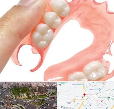 پروتز متحرک دندان در سبلان 