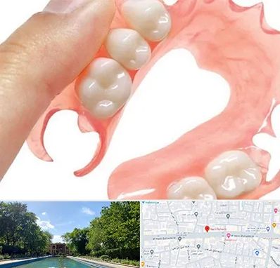 پروتز متحرک دندان در هشت بهشت اصفهان 