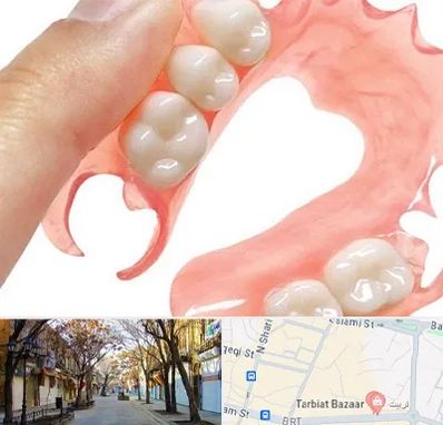 پروتز متحرک دندان در تربیت تبریز