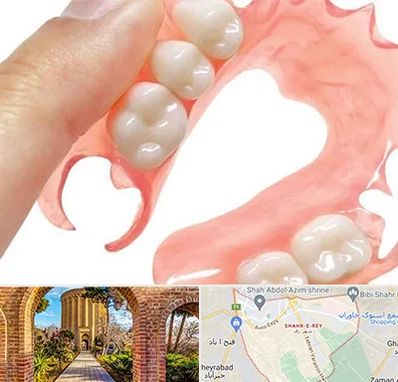 پروتز متحرک دندان در شهر ری