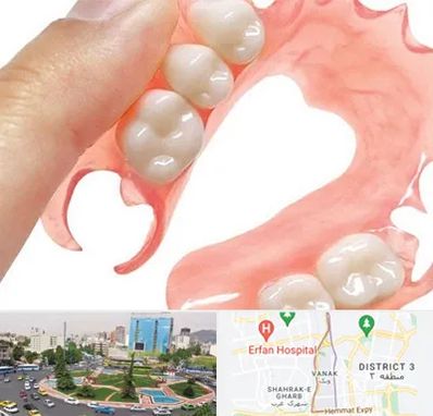 پروتز متحرک دندان در ونک 