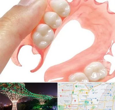 پروتز متحرک دندان در منطقه 3 تهران 