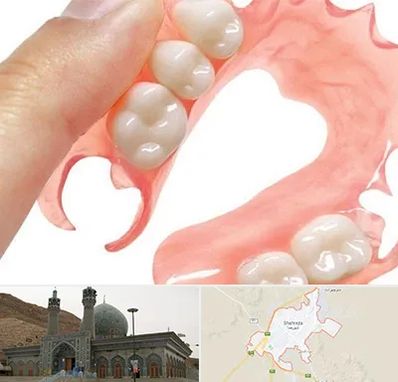 پروتز متحرک دندان در شهرضا