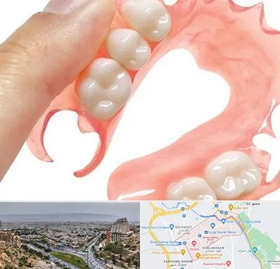 پروتز متحرک دندان در معالی آباد شیراز 