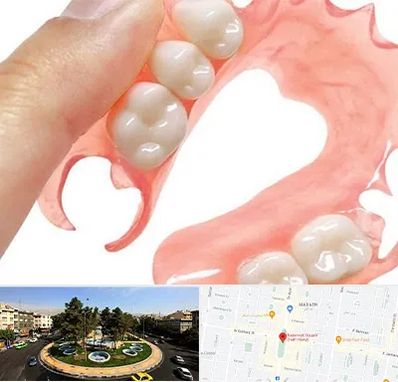 پروتز متحرک دندان در هفت حوض 