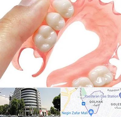 پروتز متحرک دندان در قلهک 