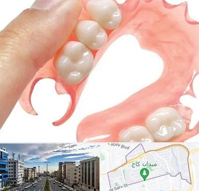 پروتز متحرک دندان در سعادت آباد 