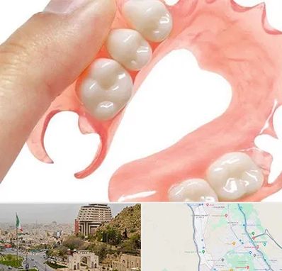 پروتز متحرک دندان در فرهنگ شهر شیراز 