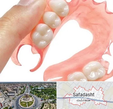 پروتز متحرک دندان در صفادشت