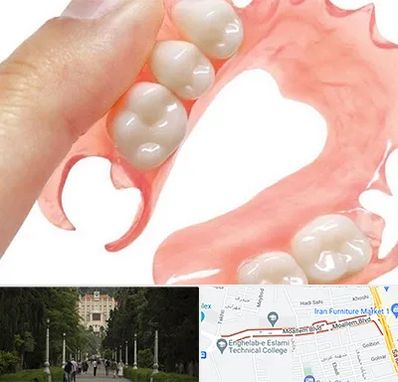 پروتز متحرک دندان در بلوار معلم رشت 