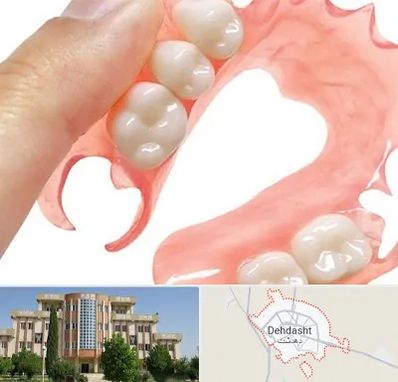 پروتز متحرک دندان در دهدشت