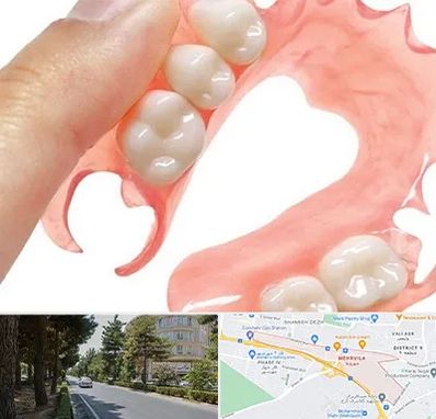 پروتز متحرک دندان در مهرویلا کرج 