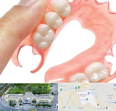 پروتز متحرک دندان در نسیم شهر