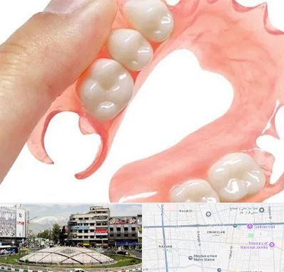 پروتز متحرک دندان در مرکز تهران