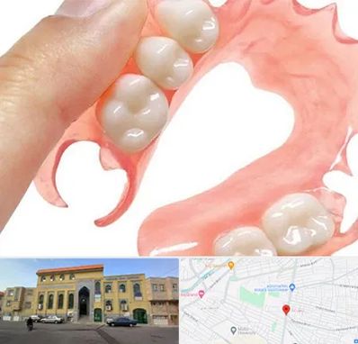 پروتز متحرک دندان در زنبیل آباد قم