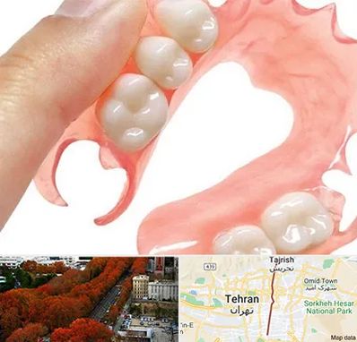 پروتز متحرک دندان در ولیعصر 