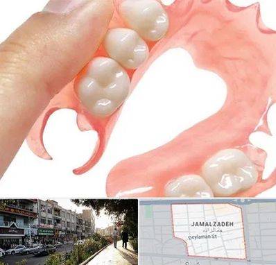 پروتز متحرک دندان در خیابان جمالزاده