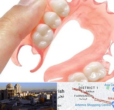 پروتز متحرک دندان در فرمانیه 