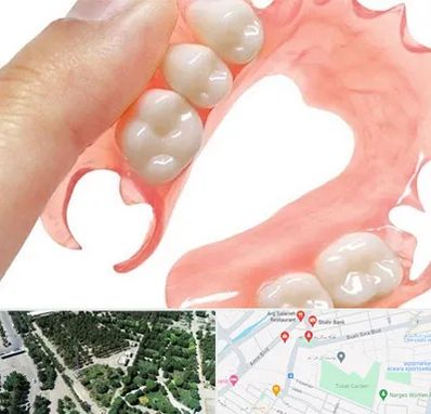 پروتز متحرک دندان در سالاریه قم