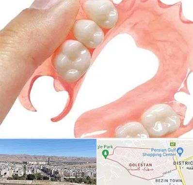 پروتز متحرک دندان در شهرک گلستان شیراز 