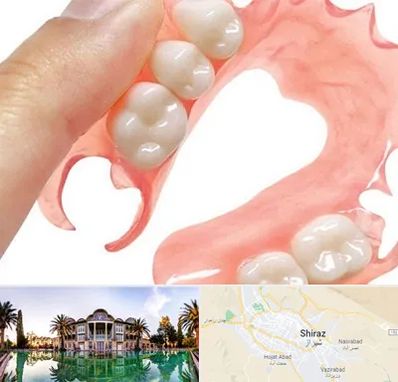 پروتز متحرک دندان در شیراز