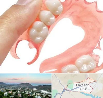 پروتز متحرک دندان در لواسان