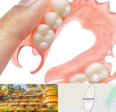 پروتز متحرک دندان در دربند