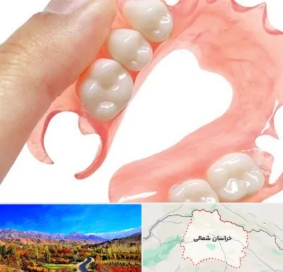 پروتز متحرک دندان در خراسان شمالی