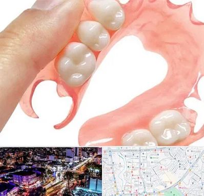 پروتز متحرک دندان در منظریه رشت 