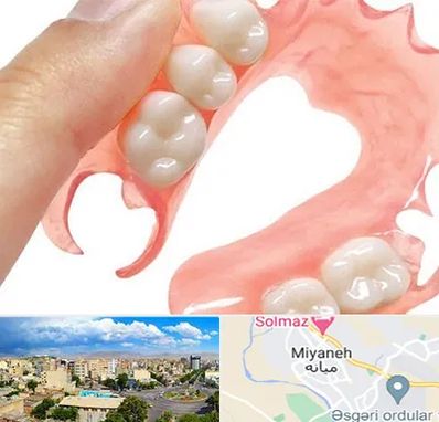 پروتز متحرک دندان در میانه