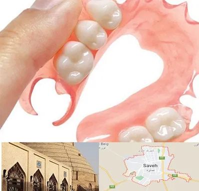 پروتز متحرک دندان در ساوه