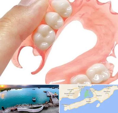 پروتز متحرک دندان در قشم