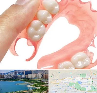 پروتز متحرک دندان در منطقه 22 تهران 