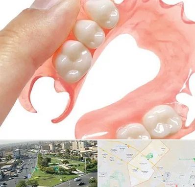 پروتز متحرک دندان در کمال شهر کرج 