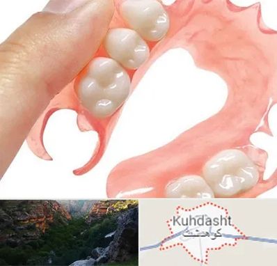 پروتز متحرک دندان در کوهدشت