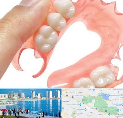 پروتز متحرک دندان در چیتگر 