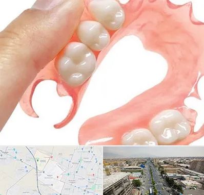 پروتز متحرک دندان در حصارک کرج 