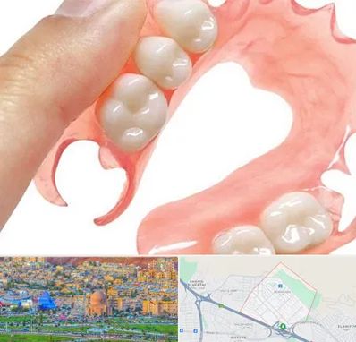 پروتز متحرک دندان در رشدیه تبریز