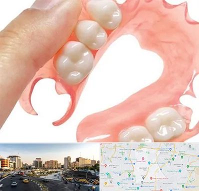 پروتز متحرک دندان در منطقه 7 تهران 