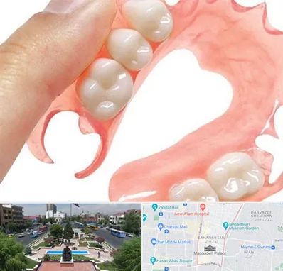 پروتز متحرک دندان در بهارستان 