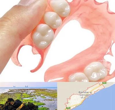 پروتز متحرک دندان در بندرلنگه