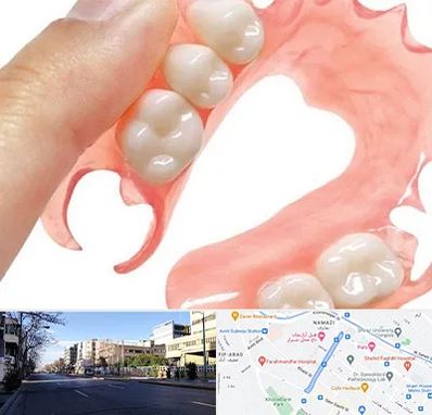 پروتز متحرک دندان در خیابان ملاصدرا شیراز 