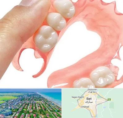 پروتز متحرک دندان در ساری