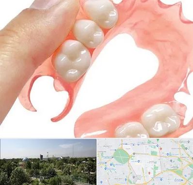 پروتز متحرک دندان در منطقه 16 تهران 