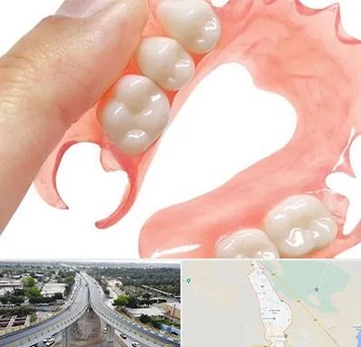 پروتز متحرک دندان در اندیمشک