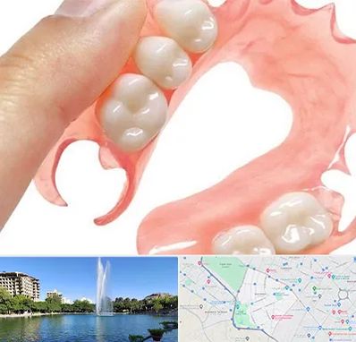 پروتز متحرک دندان در کوهسنگی مشهد 