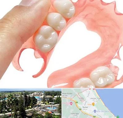 پروتز متحرک دندان در رودسر