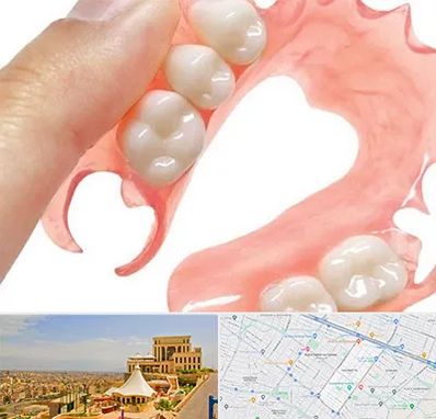 پروتز متحرک دندان در هاشمیه مشهد 